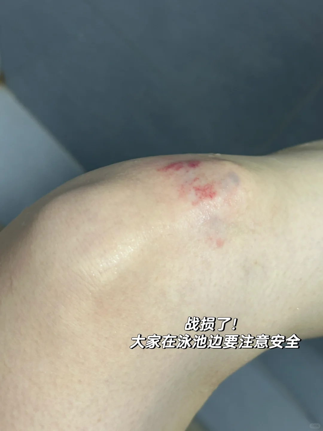 🔥打工人下班游泳瘦20斤全记录🏊