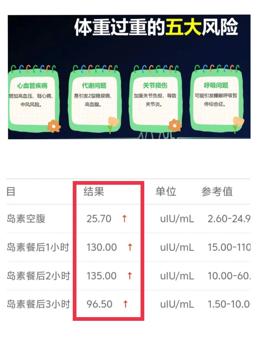 胰岛素抵抗不等于糖尿病