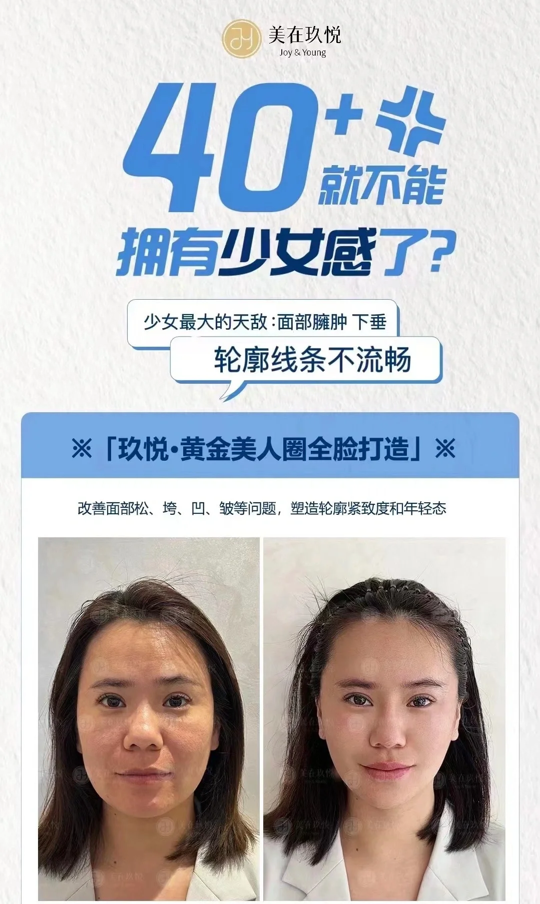 黄金美人圈