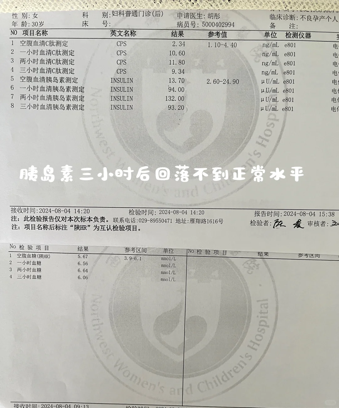 胰岛抵抗如何高效备孕