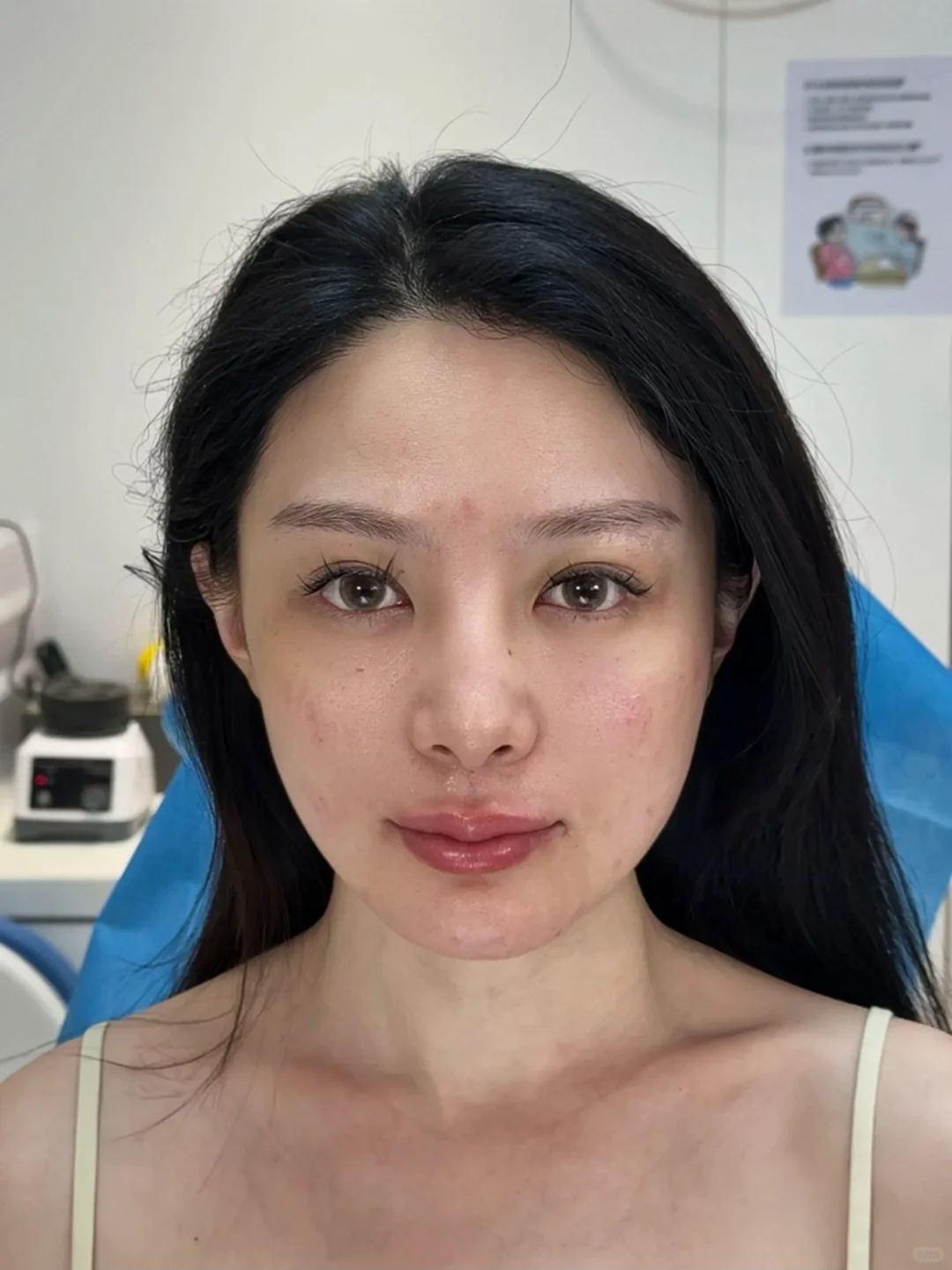 35岁，调完像女大了吗？