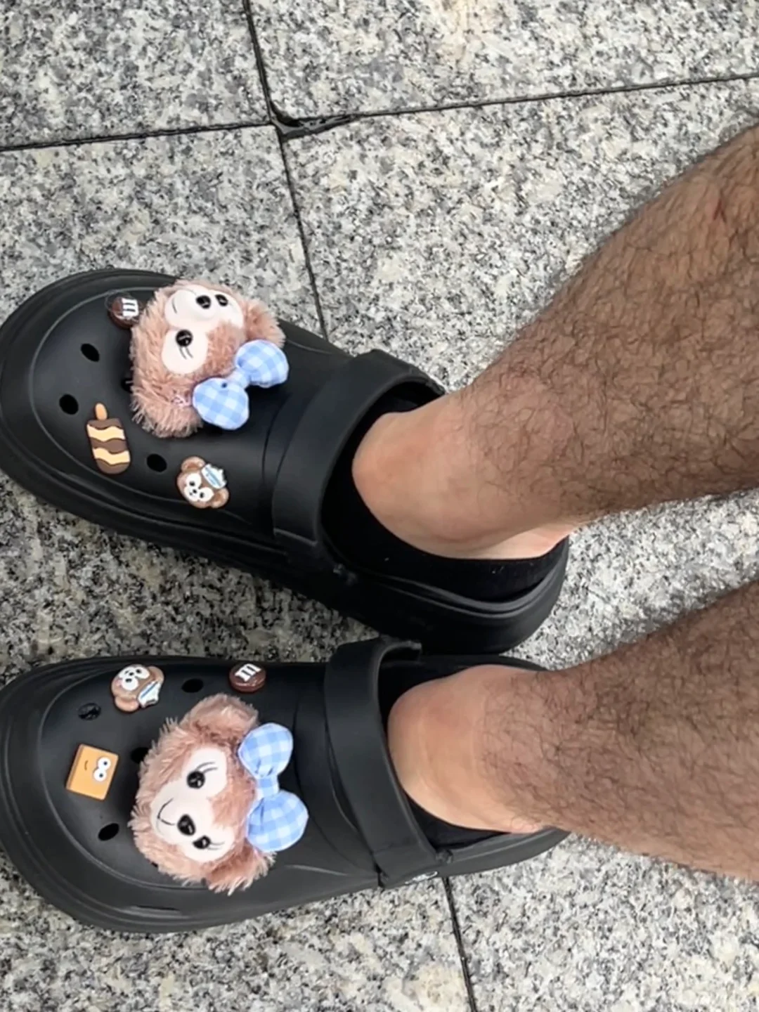 救命‼️，我一个女孩子这腿毛正常嘛😭😭