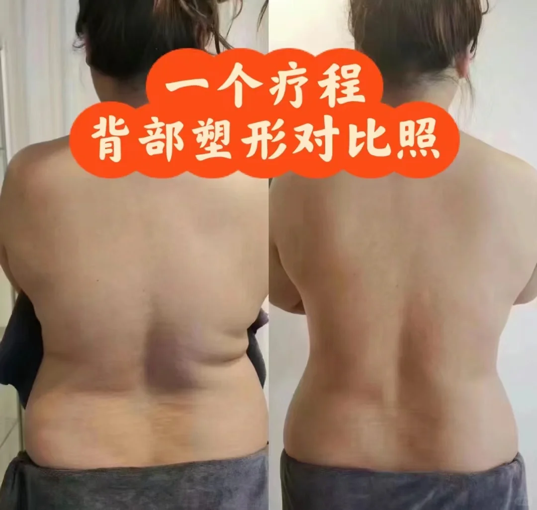 打造完美身材的秘密武器—不可或缺的塑身衣
