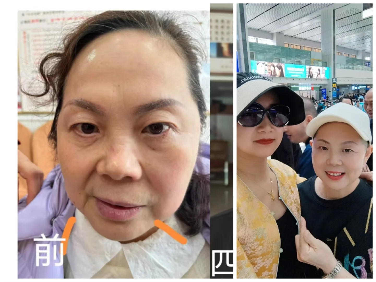 你 爱美吗？
