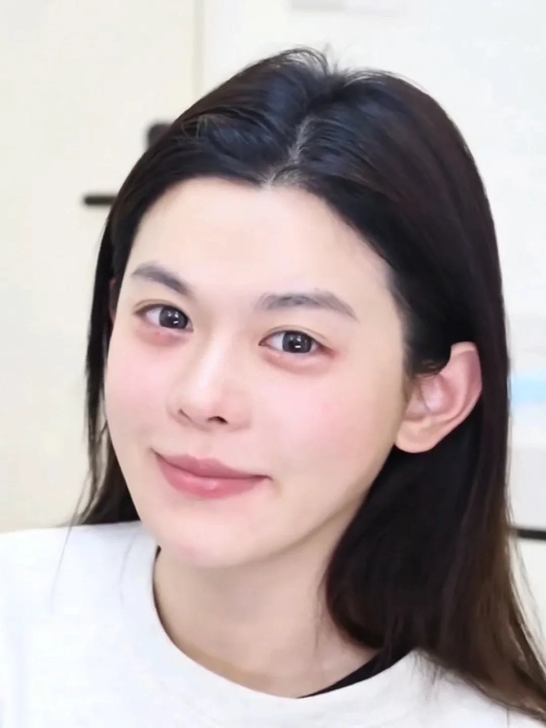 妈生感医美思路