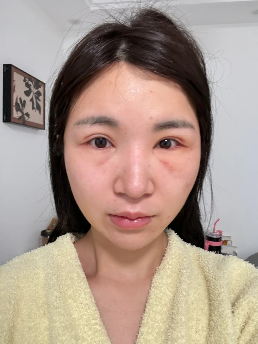 怎么有种一边脸大 一边脸小的多感觉呢