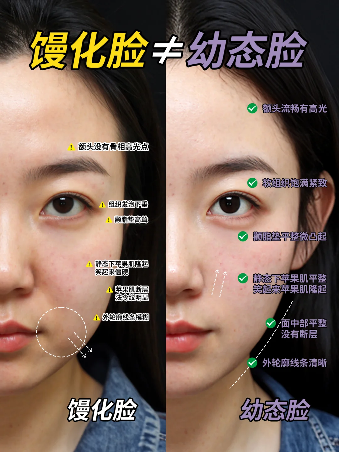 🔥馒化脸≠幼态脸❗Get你的轻薄脸