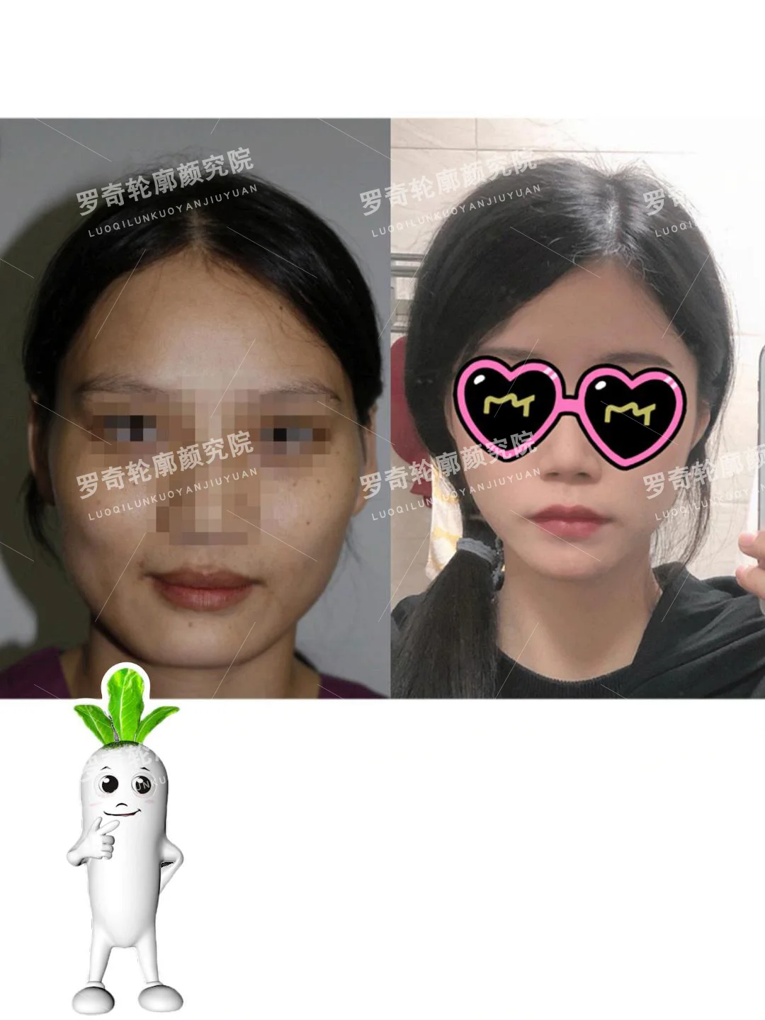 大脸变小脸的快乐谁懂啊~