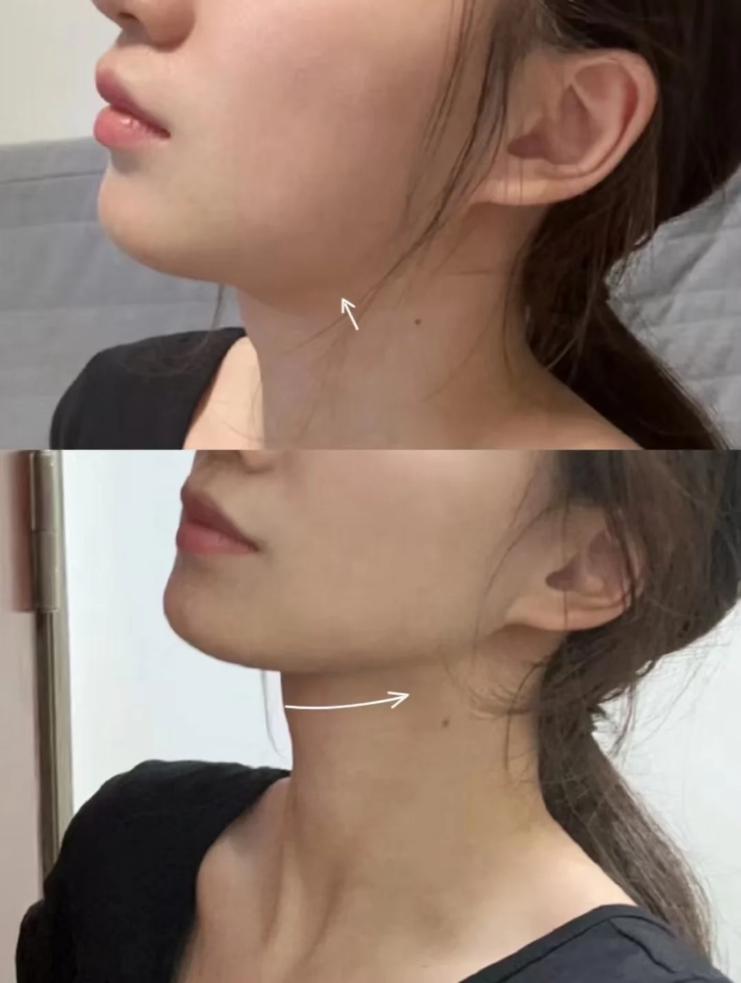 瘦脸对比🆚