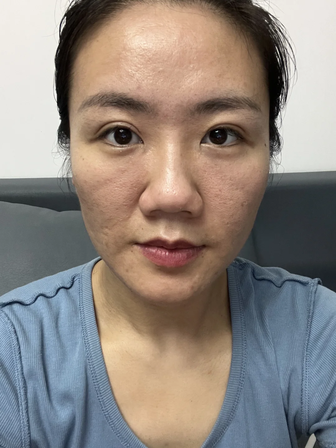 二十多岁垮脸，求求各位