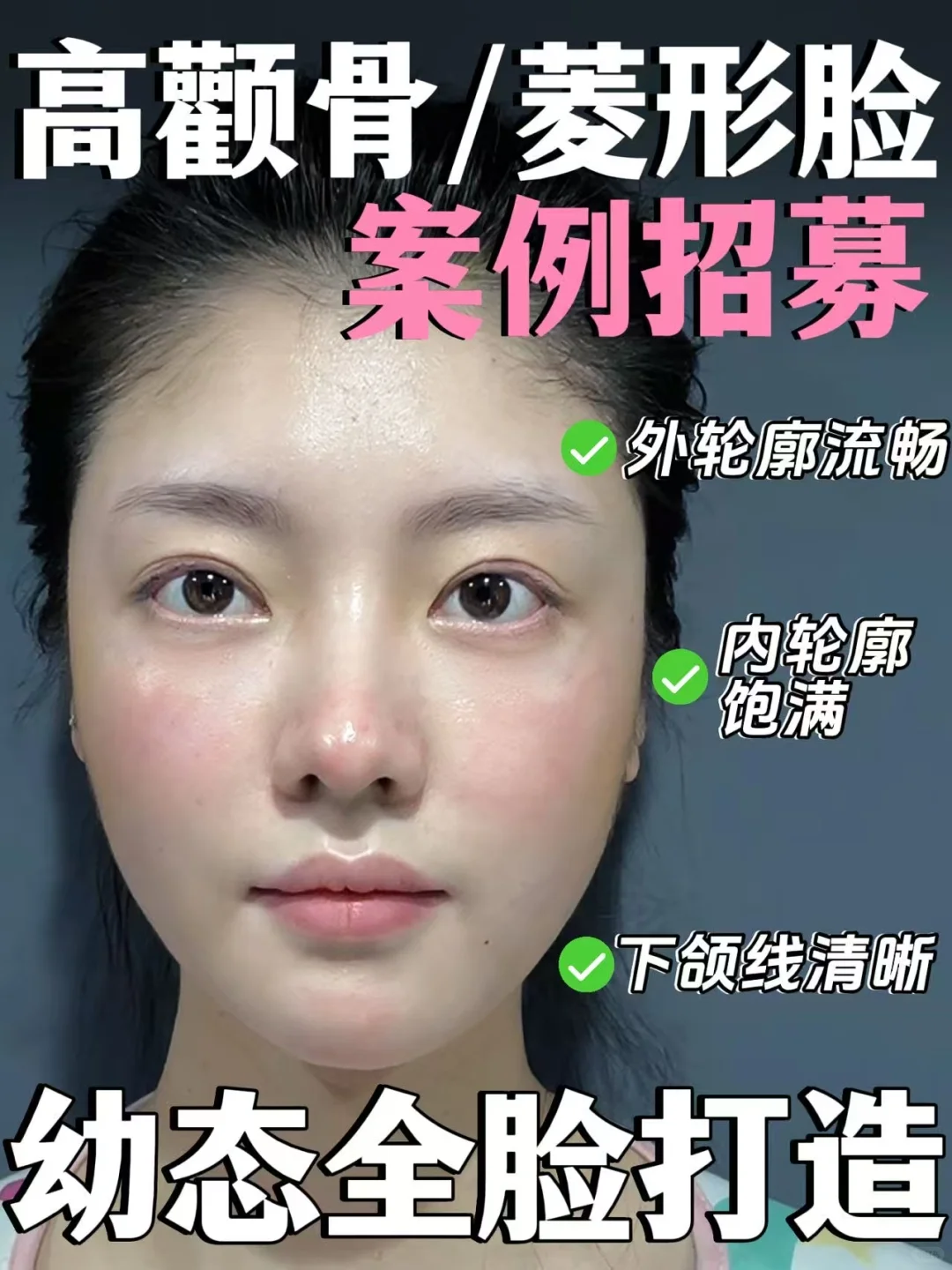 颧骨高👉🏻幼态脸变美思路 抄作业❗