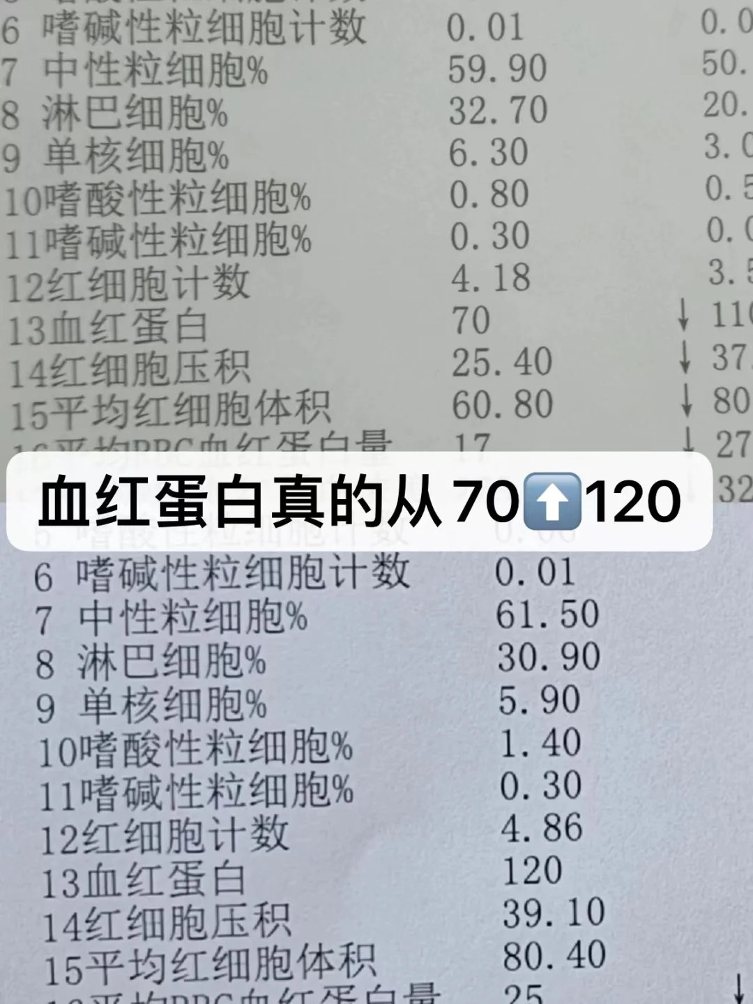 缺铁贫血，吃益安美铁粉一个月补上了
