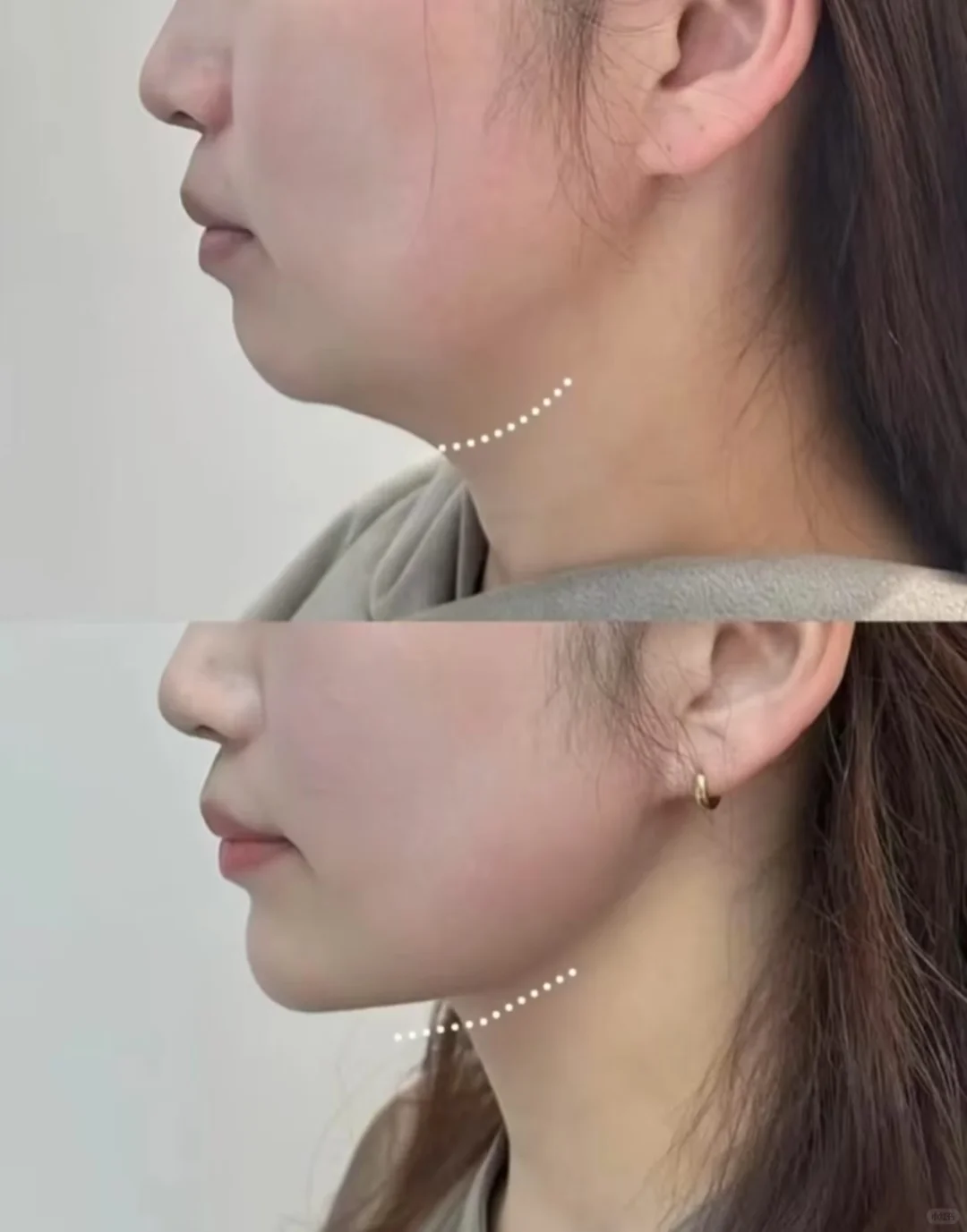 轮廓清晰视觉上的少女感