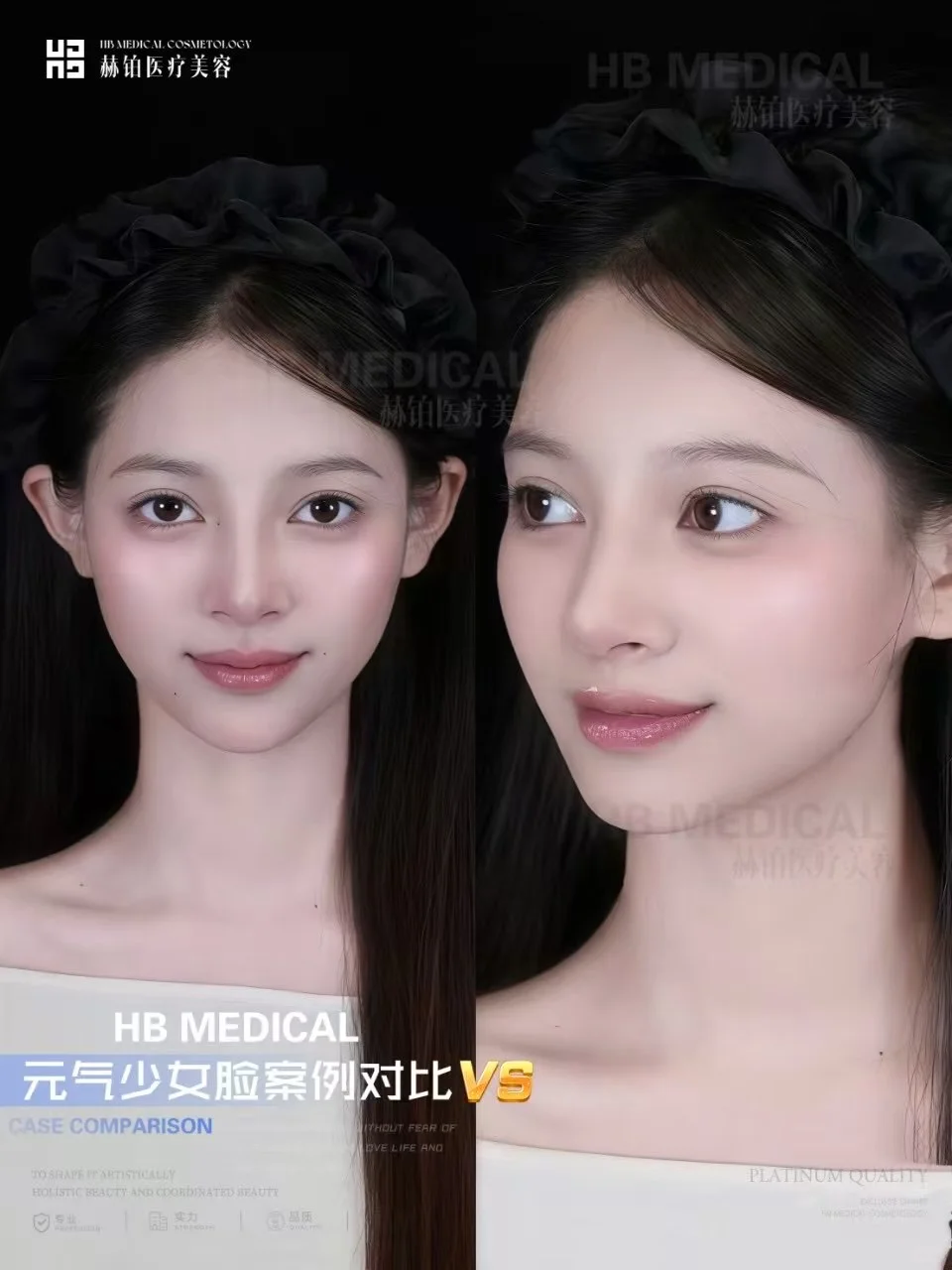 脸型改造，元气少女脸！