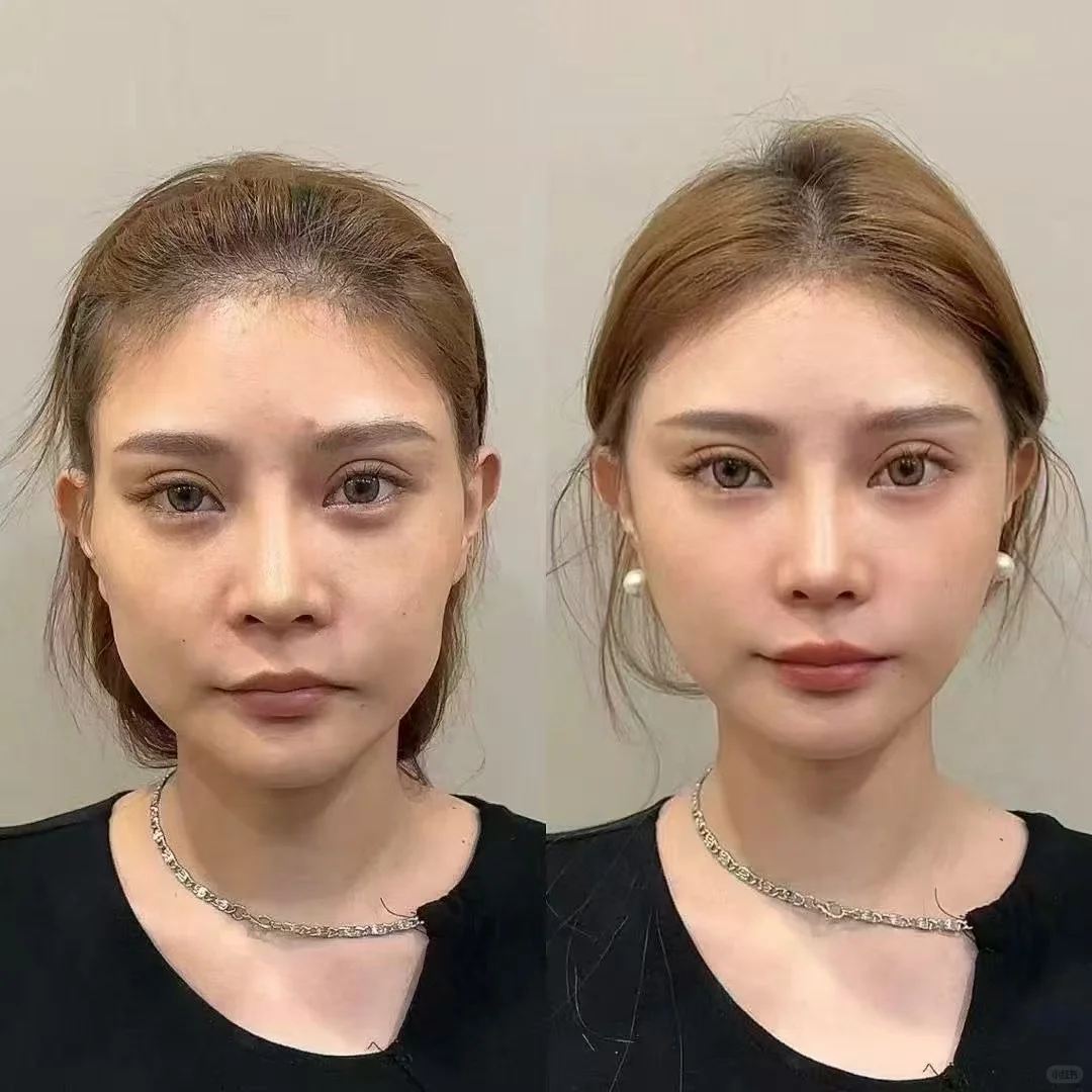 原相机，不ps，原生美‼️