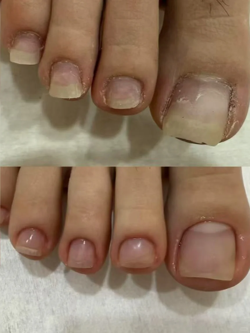 美足的意义