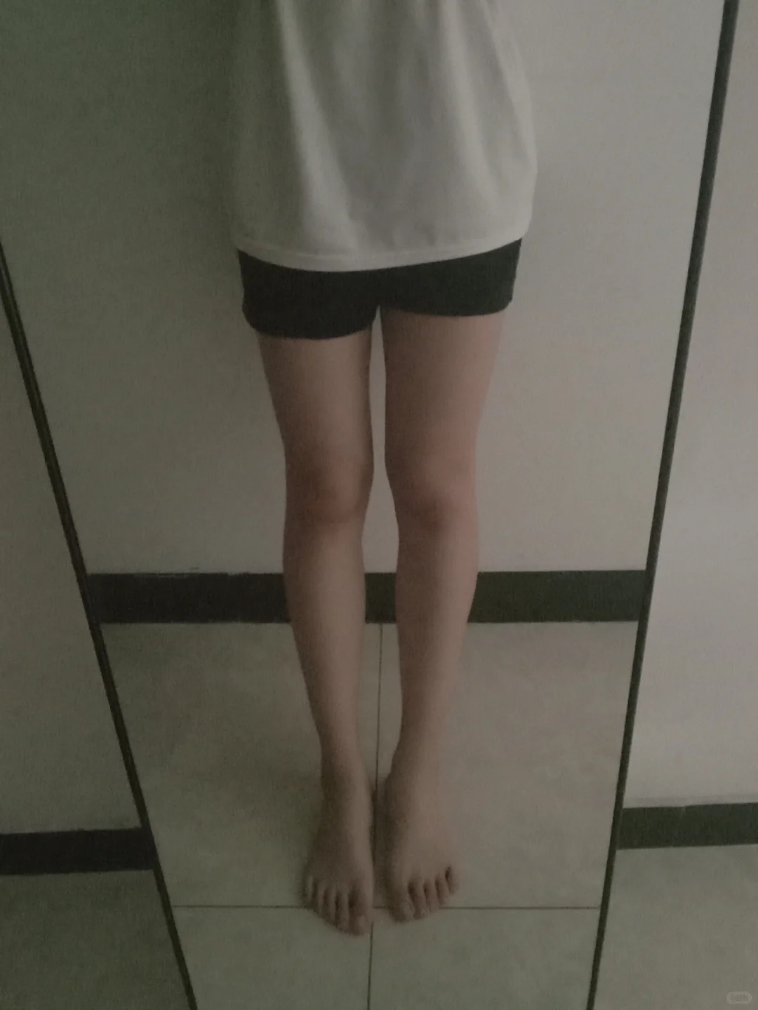 这个腿……