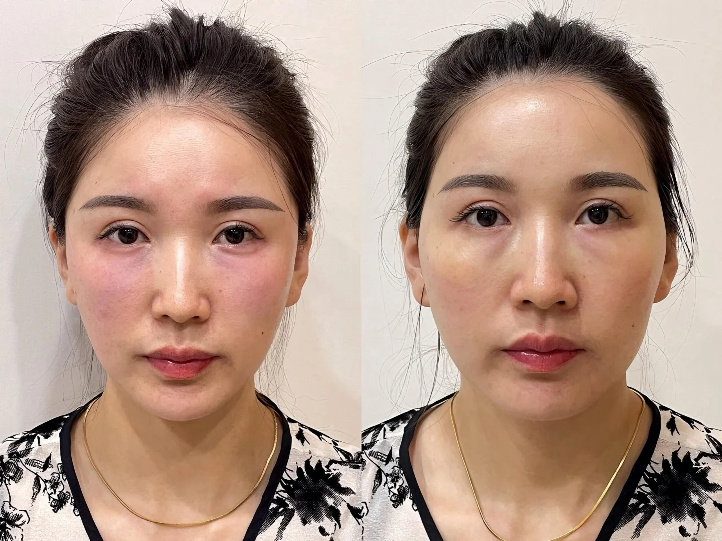 面部美学分析，要怎么做脸才能好看呢？