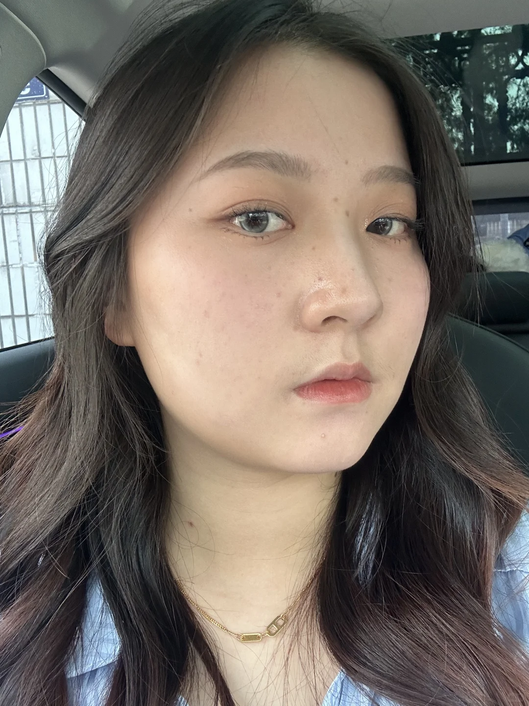 右滑➡️吃激素两个月整的变化