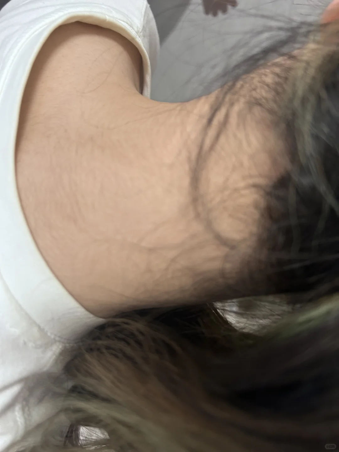 能帮忙看一下我的脖子是胰岛素抵抗吗