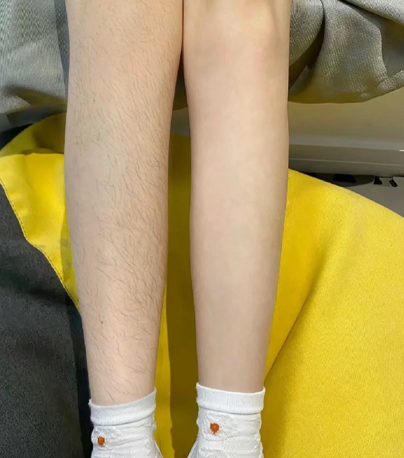 和腿毛说拜拜👋