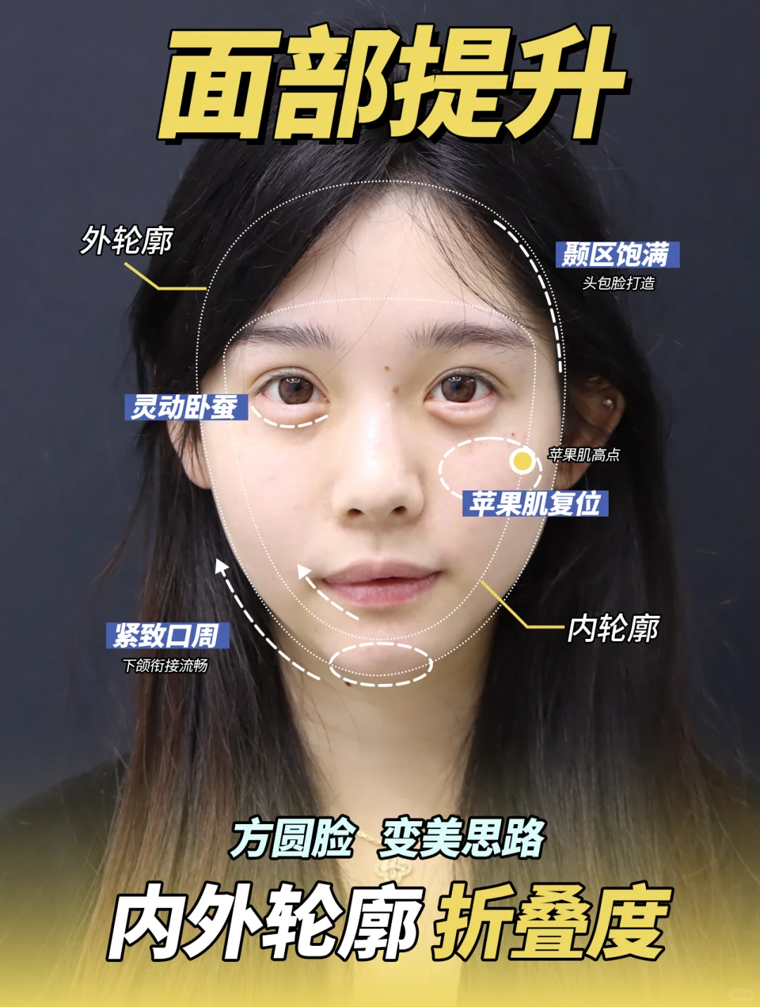 方圆脸变美：内外轮廓立体感+面部折叠度