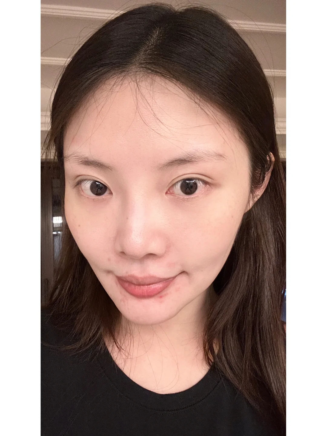 终于和自己的腿型和解