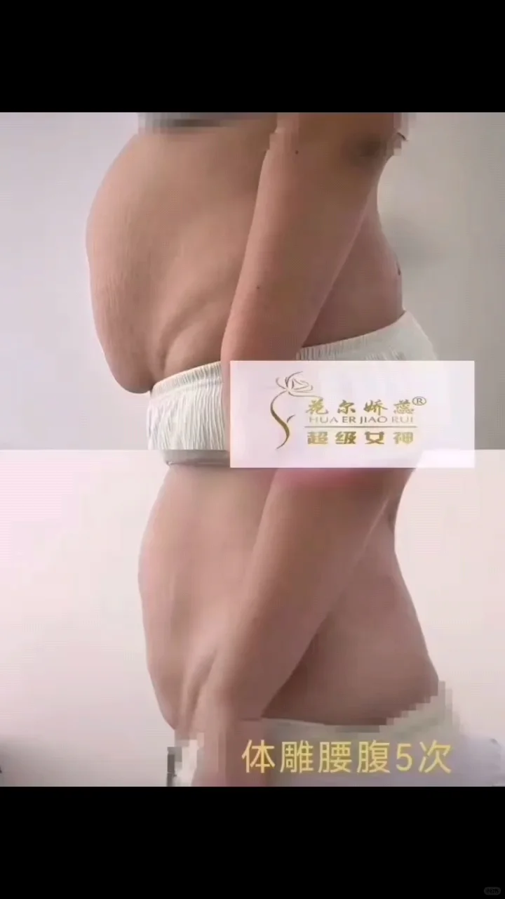 王炸体雕，展现不一样的你