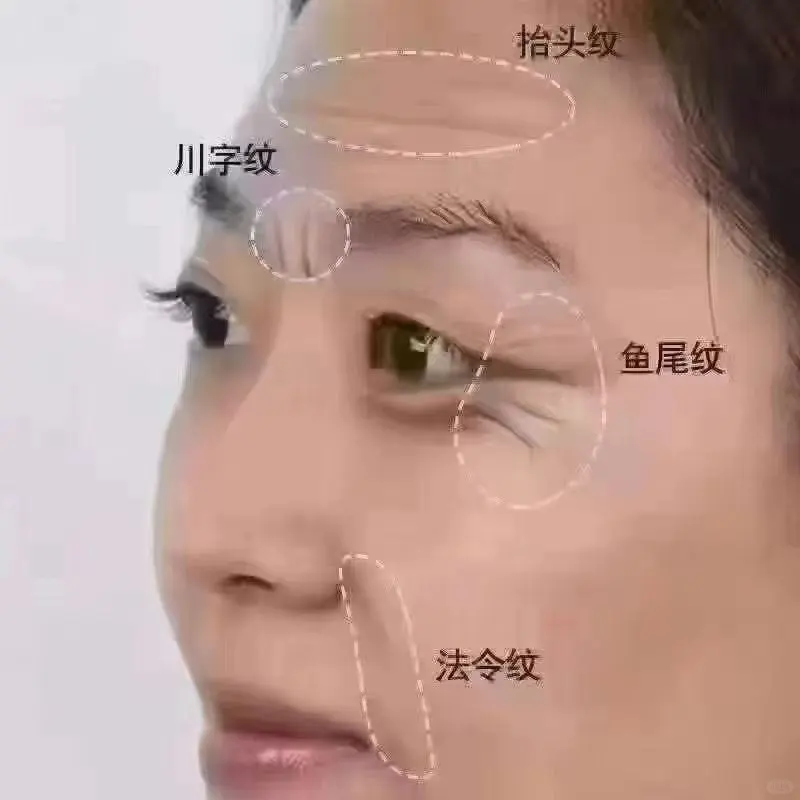 先美一步，便能胜人一筹～☘️除皱🆚