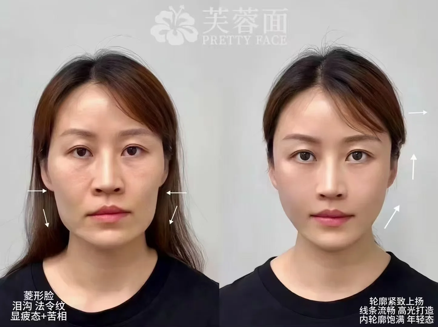 搞事情，打造幻态脸，