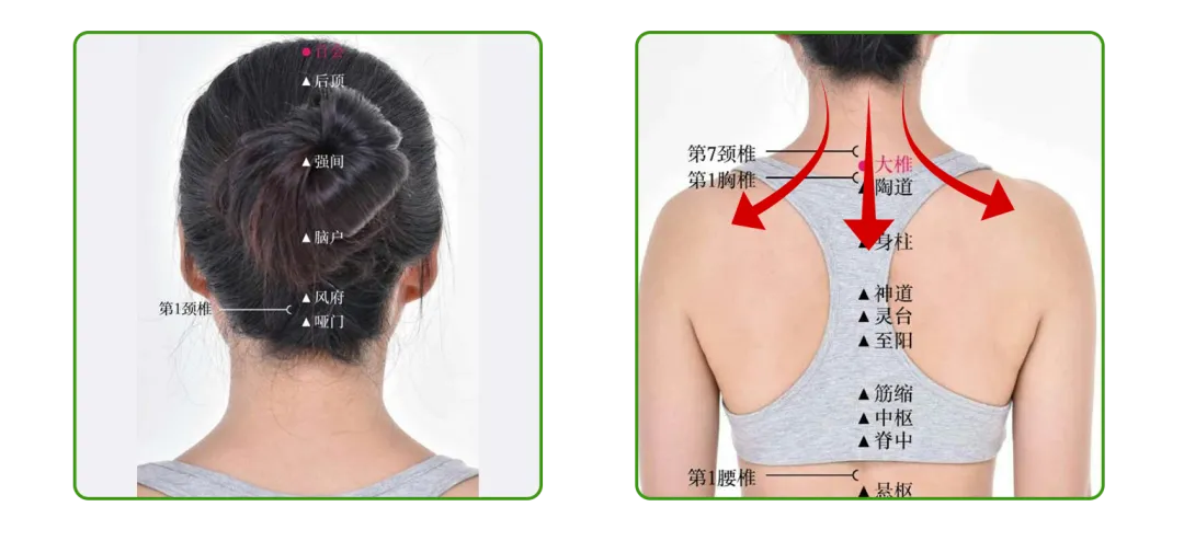 高考在即,焦虑失眠、身体不适?中医“锦囊妙计”助力考生轻装上阵 第7张