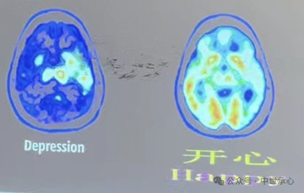 【干货】助力中高考-考前应急减压分享实录 第5张