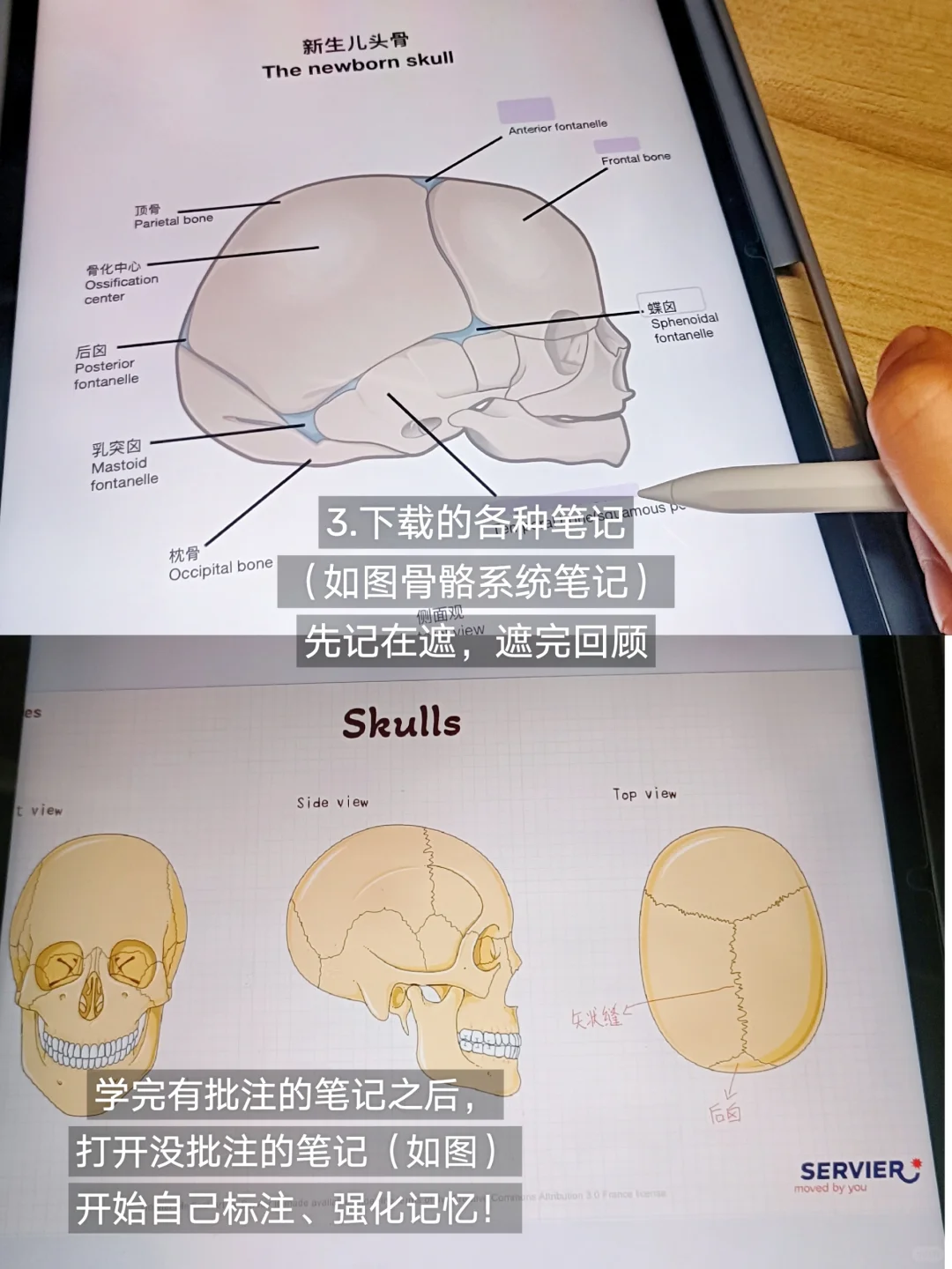 医学生实现无纸化学習🔥真的太爽了‼️