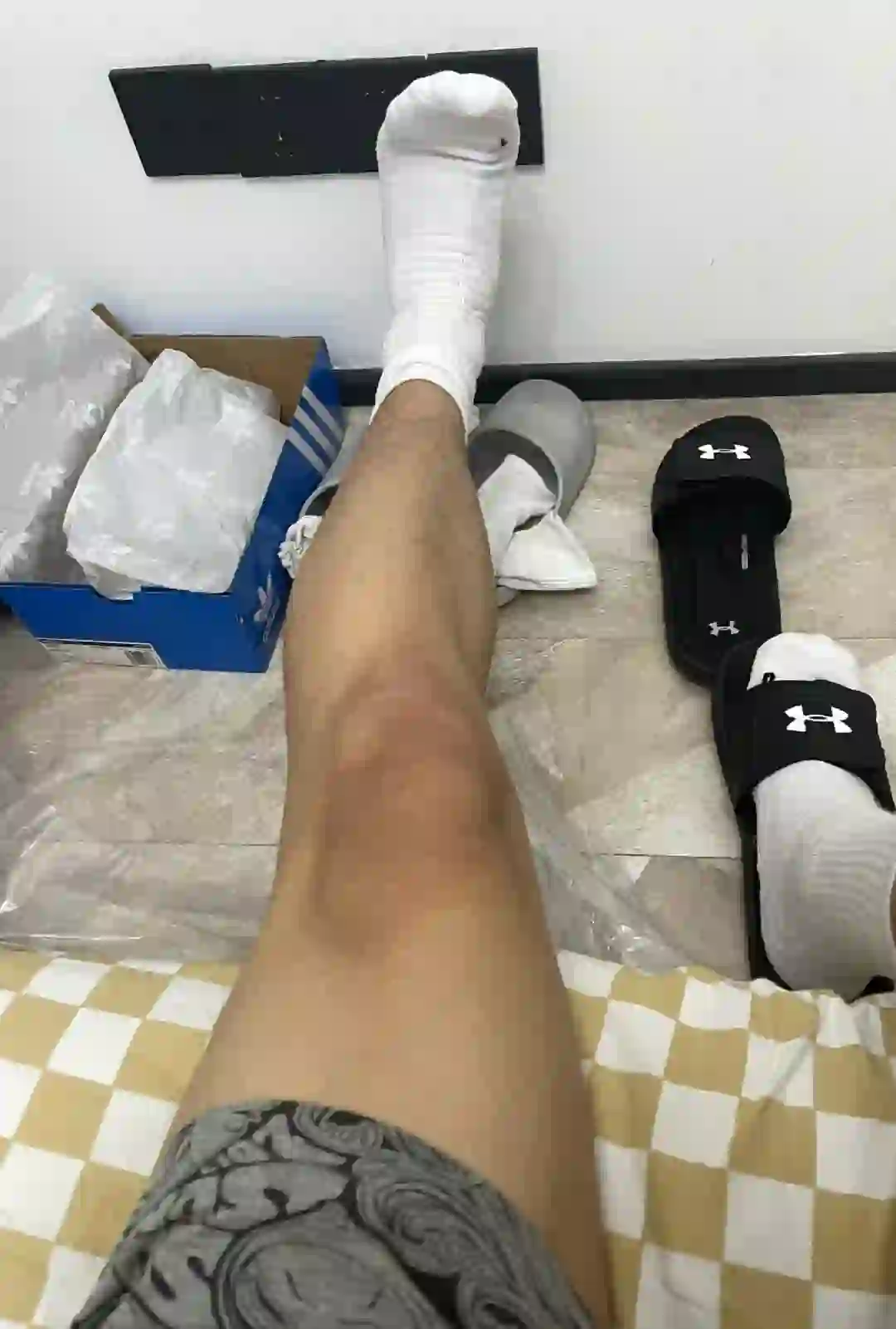 为什么膝盖黑黑的 洗也洗不掉