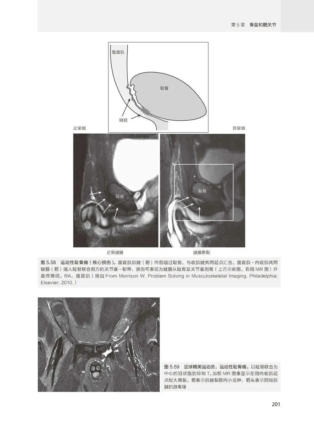 【PDF版】肌骨影像学核心知识必读第5版下载