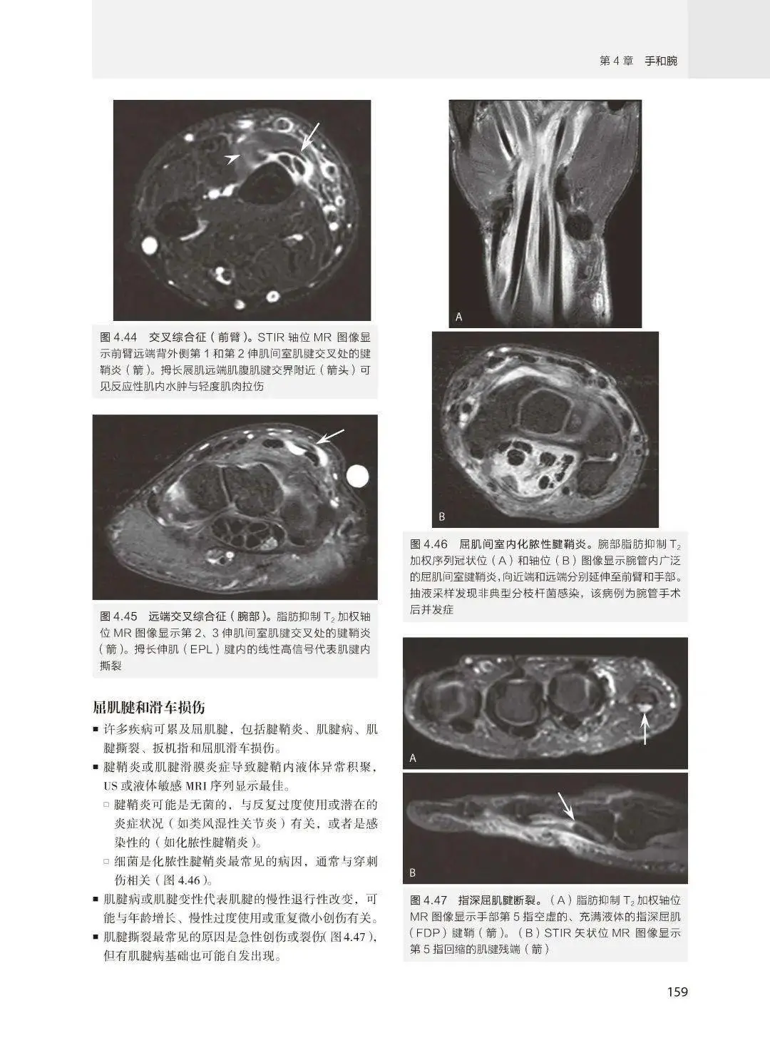 【PDF版】肌骨影像学核心知识必读第5版下载