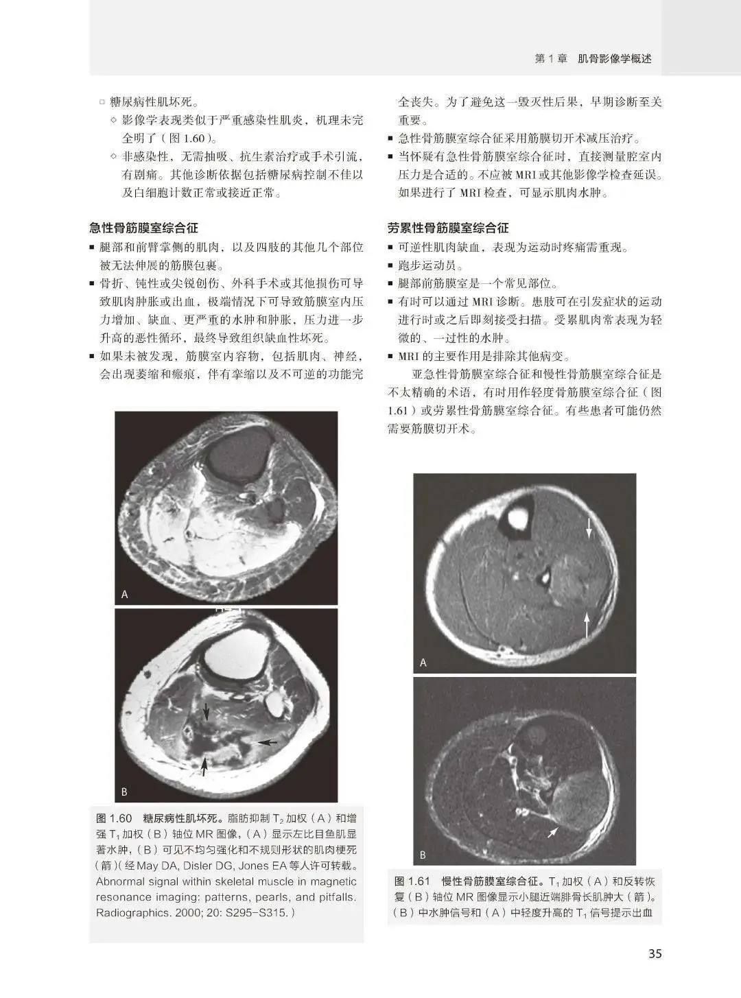 【PDF版】肌骨影像学核心知识必读第5版下载