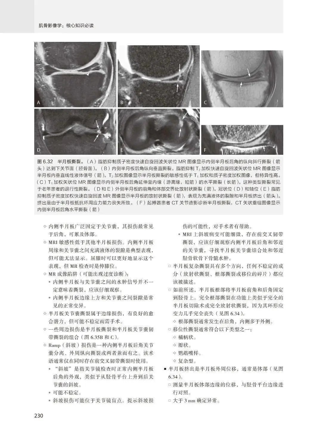 【PDF版】肌骨影像学核心知识必读第5版下载