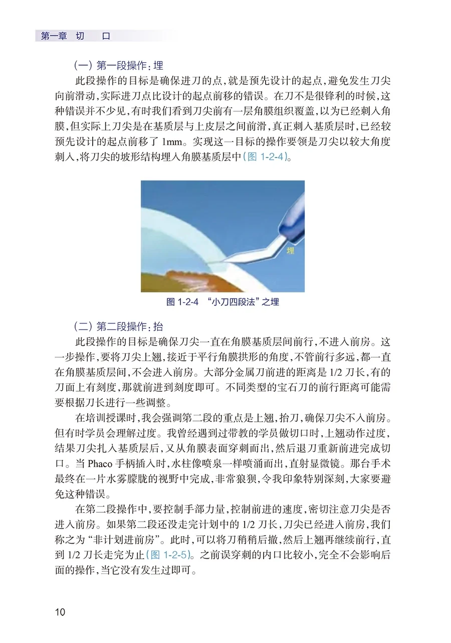 一步一步学会白内障手术pdf版电子书下载
