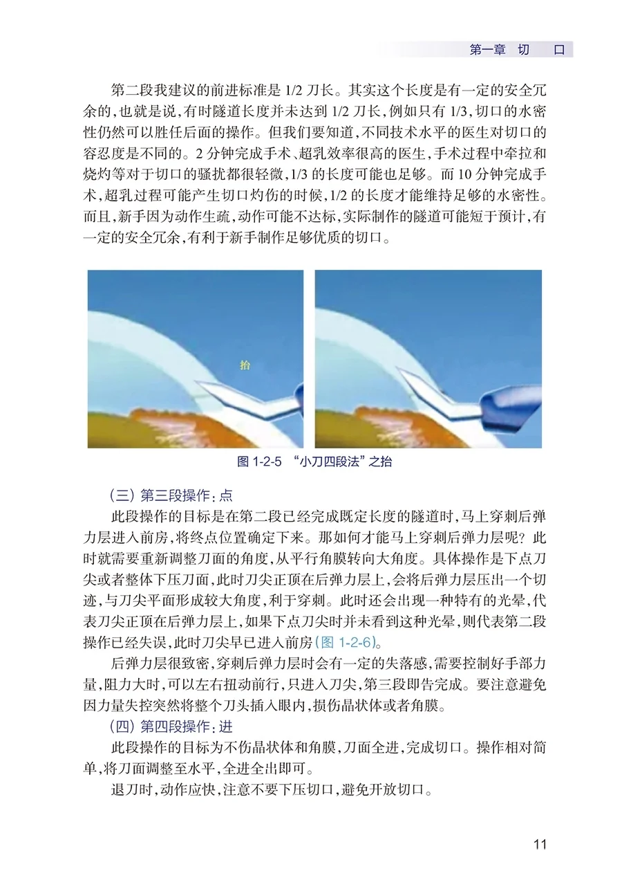 一步一步学会白内障手术pdf版电子书下载