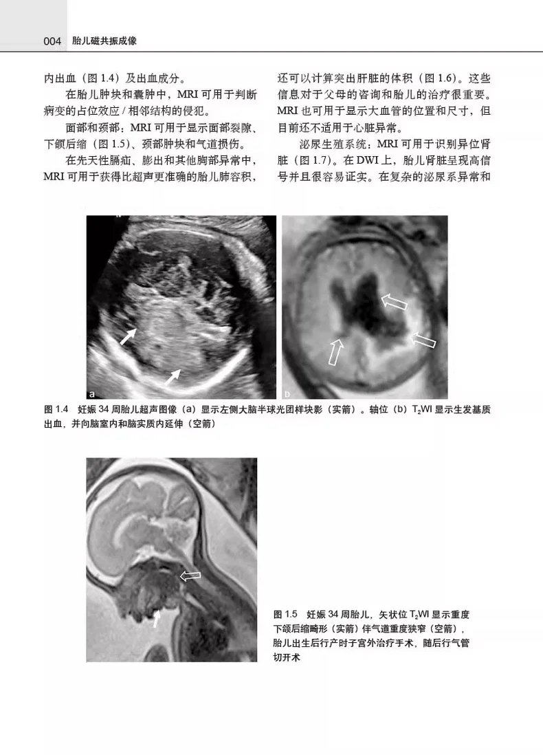 胎儿磁共振成像pdf版电子书下载