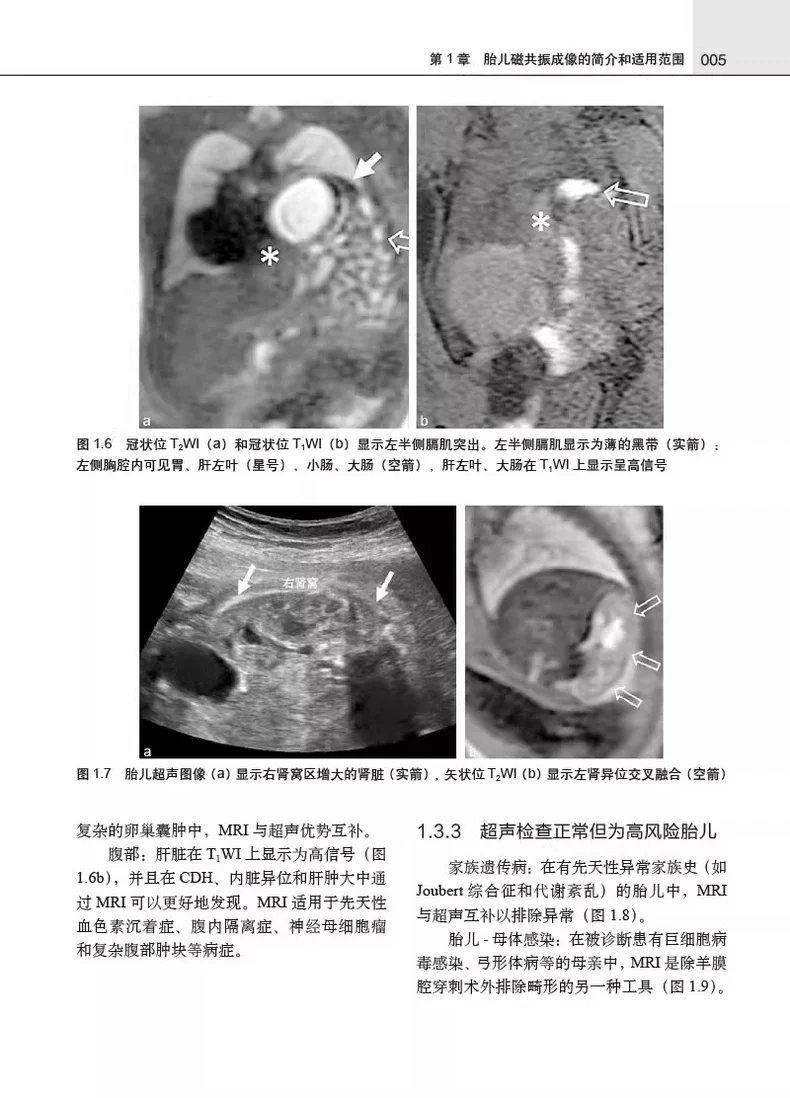 胎儿磁共振成像pdf版电子书下载