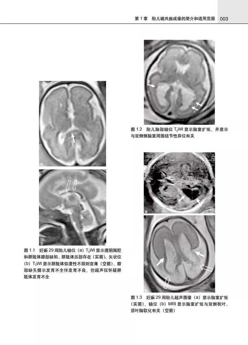 胎儿磁共振成像pdf版电子书下载